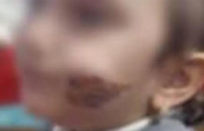 في مصر... عذّبت طفلتها وشوّهت وجهها بسبب لا يخطر على البال!