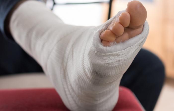 بالصورة.. ملحن شهير يتعرّض لكسر في القدم